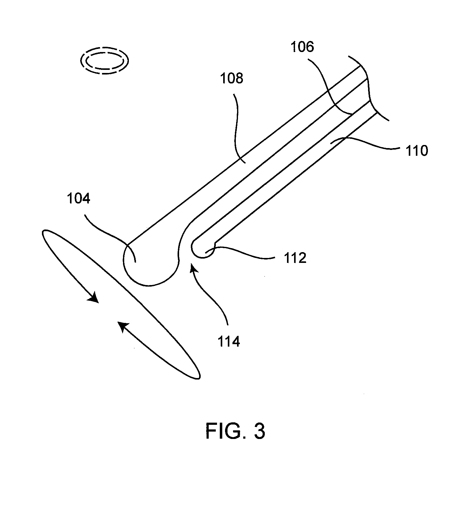 Cataract removal device and integrated tip