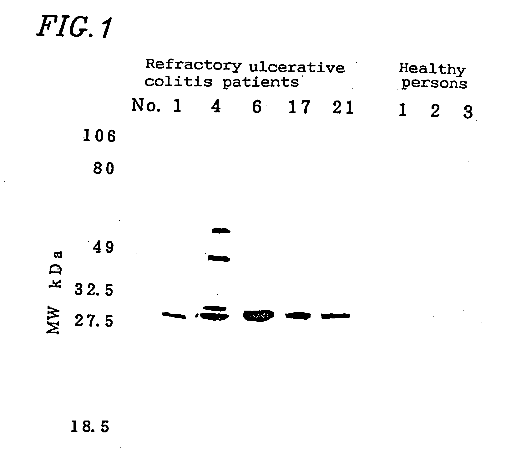 Diagnostic drugs for autoimmune diseases