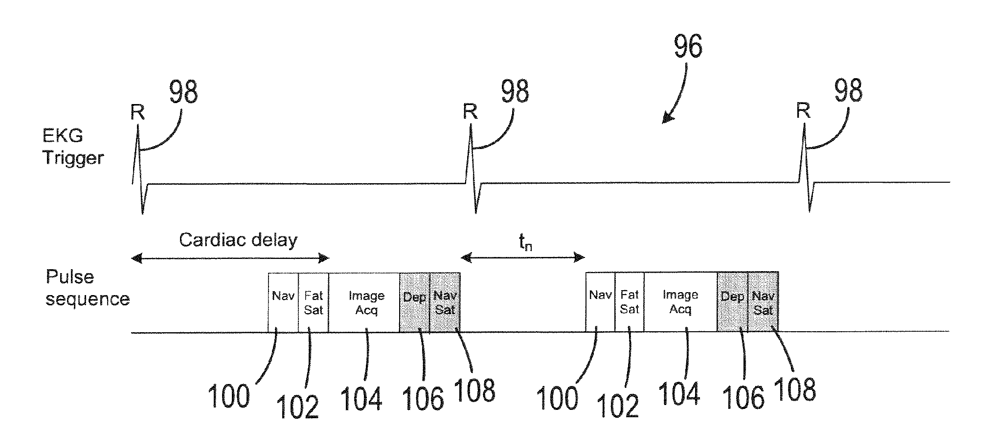 Method and apparatus for acquiring free-breathing MR images using navigator echo with saturation RF pulse