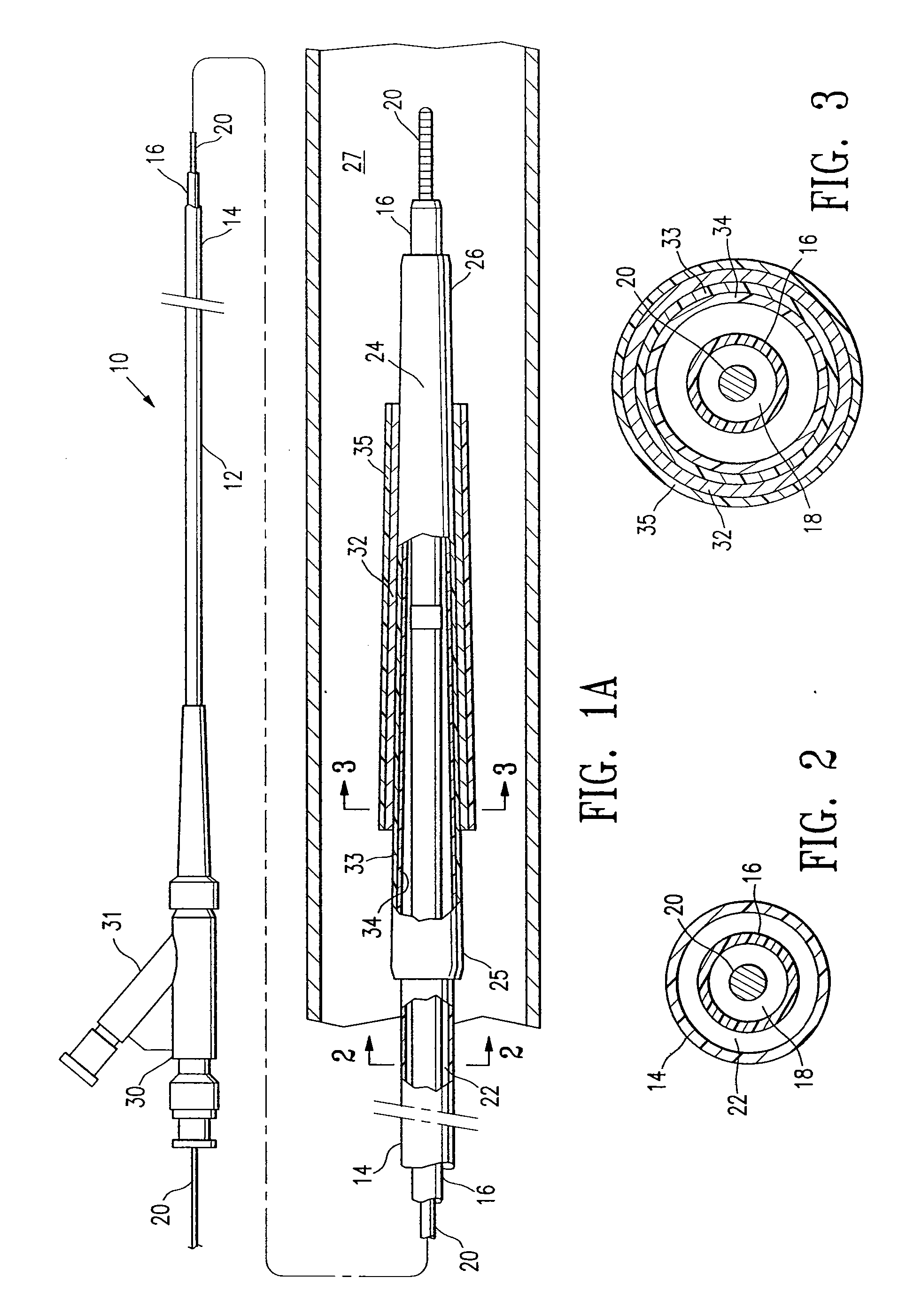 Catheter balloon