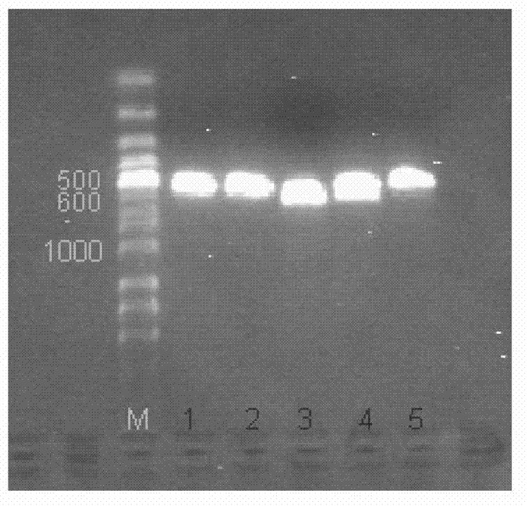 TNF (Tumor Necrosis Factor)-related apoptosis-inducing ligand fusion protein and preparation method thereof