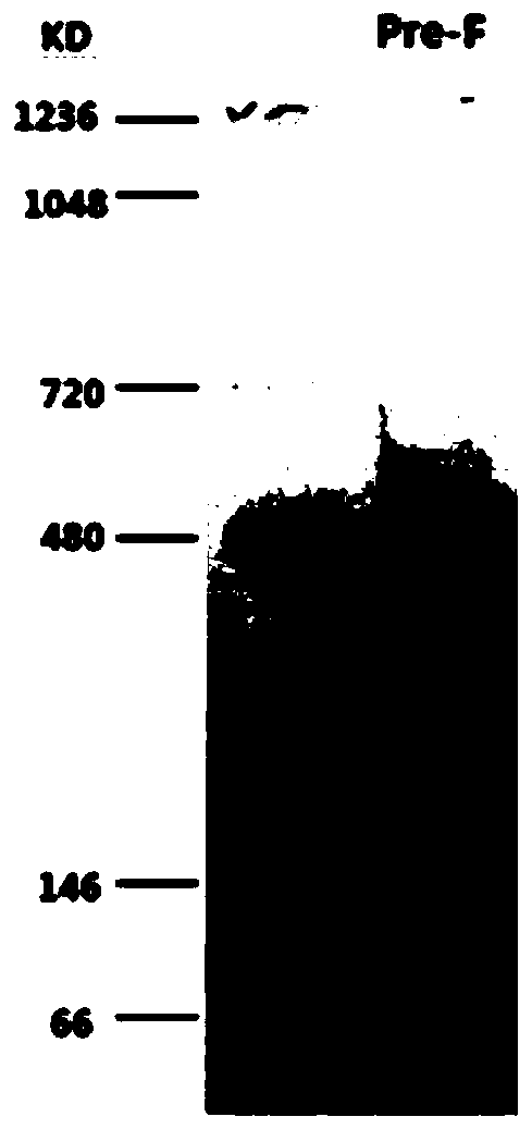 Neutralizing antibody against respiratory syncytial viruses and application thereof