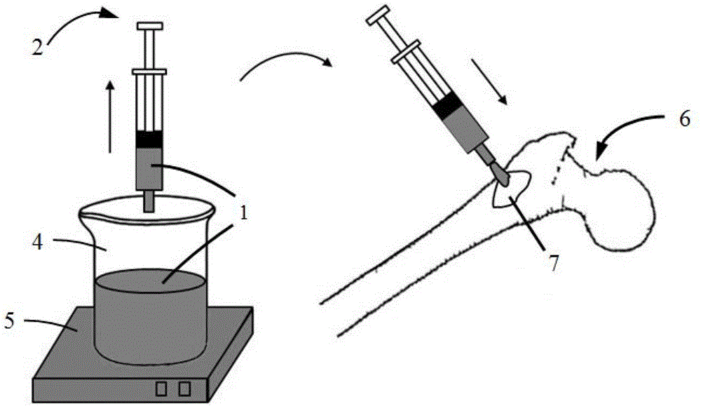 Injectable liquid metal bone cement, preparation method of injectable liquid metal bone cement and special injection device for injectable liquid metal bone cement