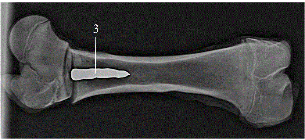 Injectable liquid metal bone cement, preparation method of injectable liquid metal bone cement and special injection device for injectable liquid metal bone cement