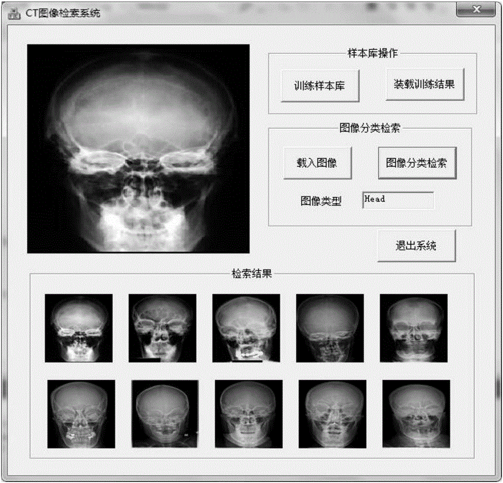 Multi-kernel hash learning-based large-scale medical image retrieval method