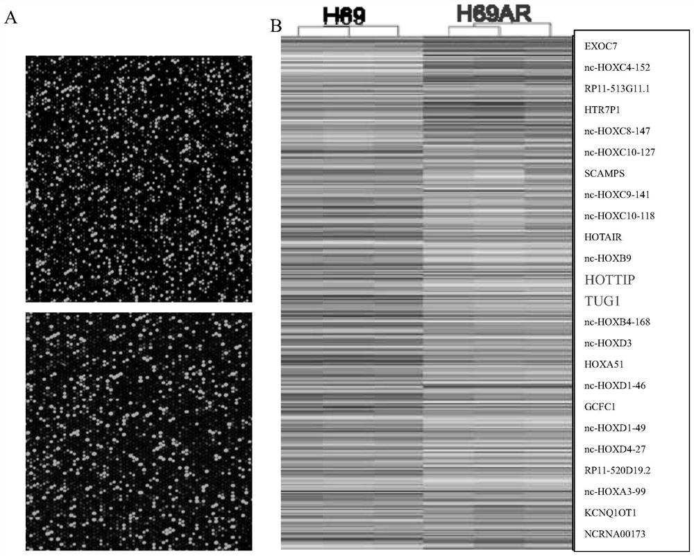 A target for predicting the sensitivity of small cell lung cancer patients to chemotherapy drugs and its application