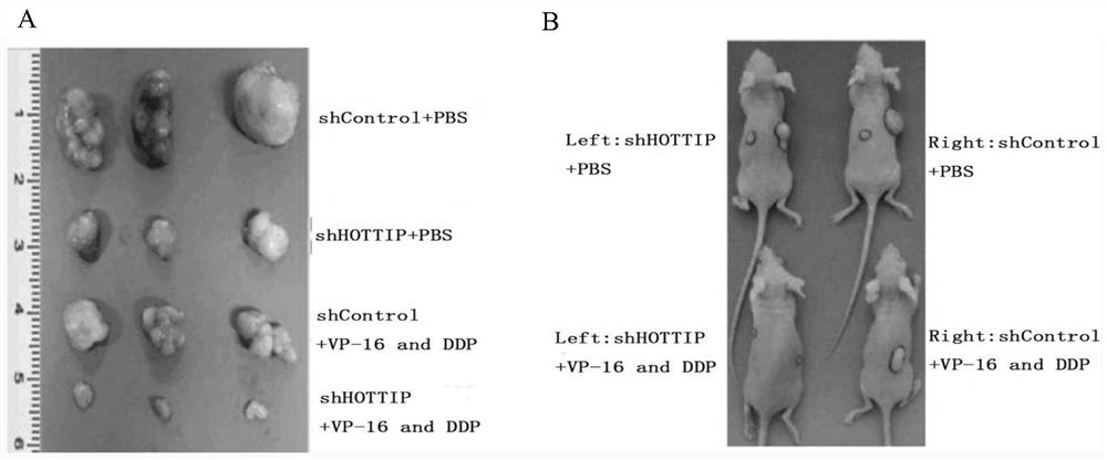 A target for predicting the sensitivity of small cell lung cancer patients to chemotherapy drugs and its application