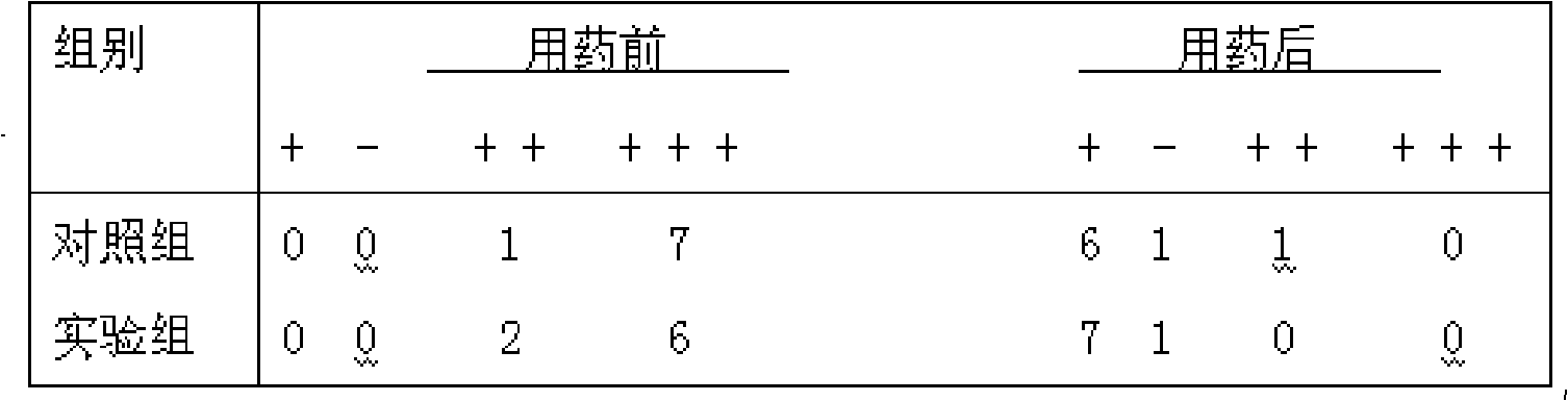 Acne ointment as well as preparation method and quality detection method thereof