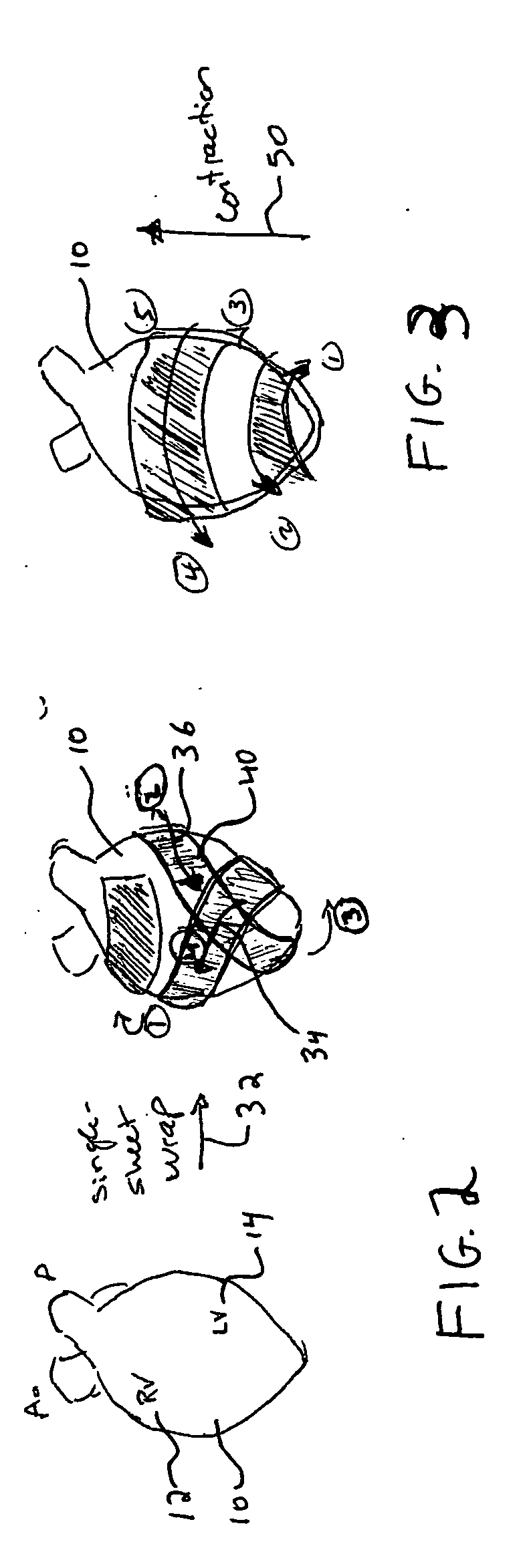 Micro electromechanical machine-based ventricular assist apparatus