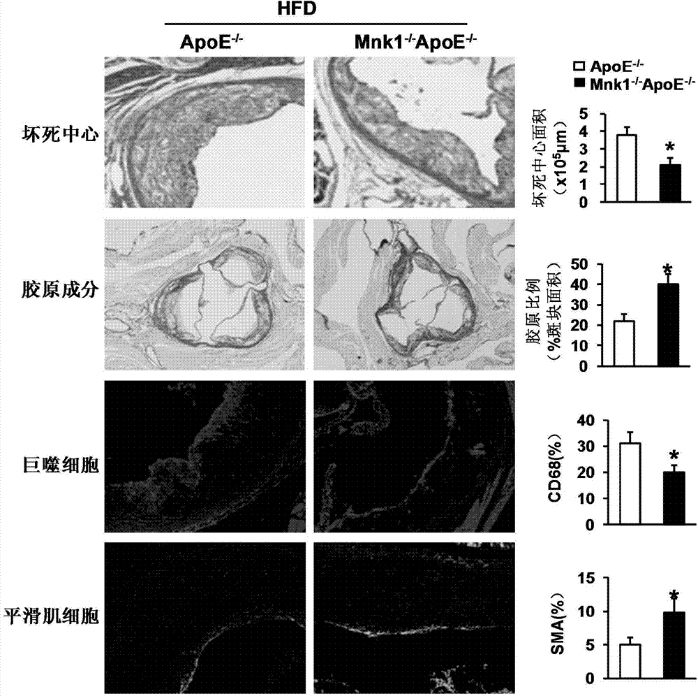 Function and application of MAPK (mitogen-activated protein kinase) signal-integrating kinase 1 in treatment of atherosclerosis