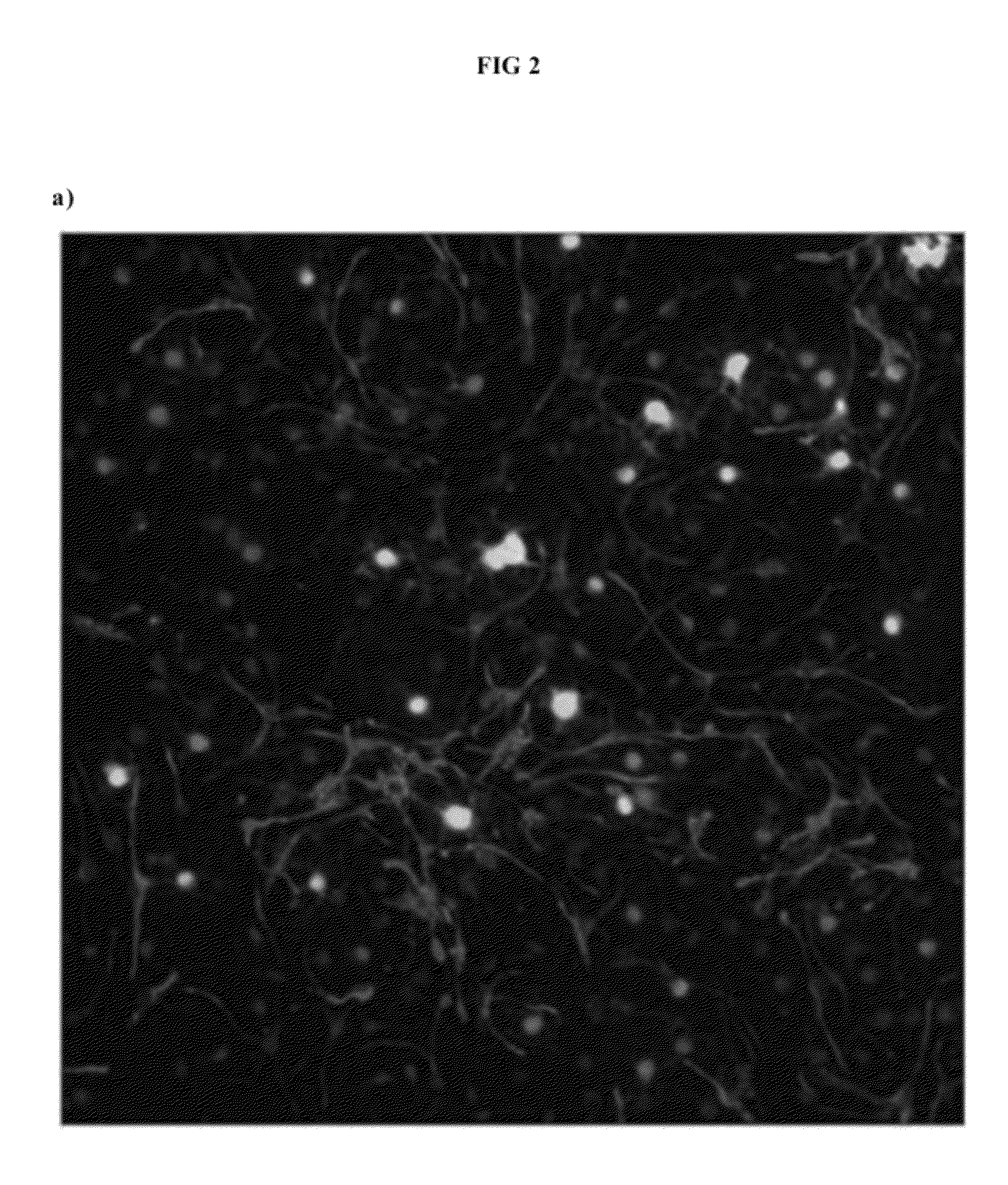 6-substituted estradiol derivatives for use in remyelination of nerve axons