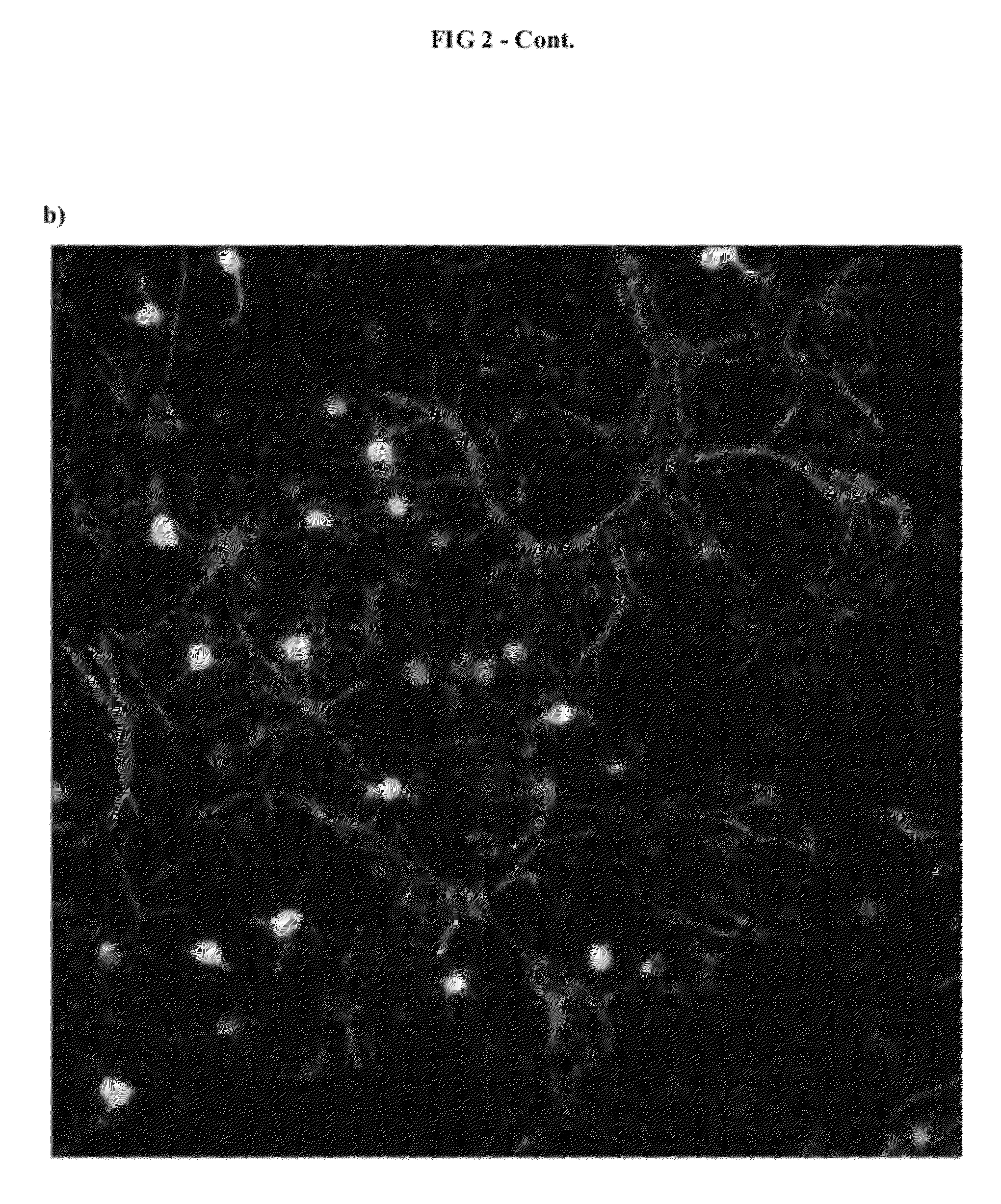 6-substituted estradiol derivatives for use in remyelination of nerve axons