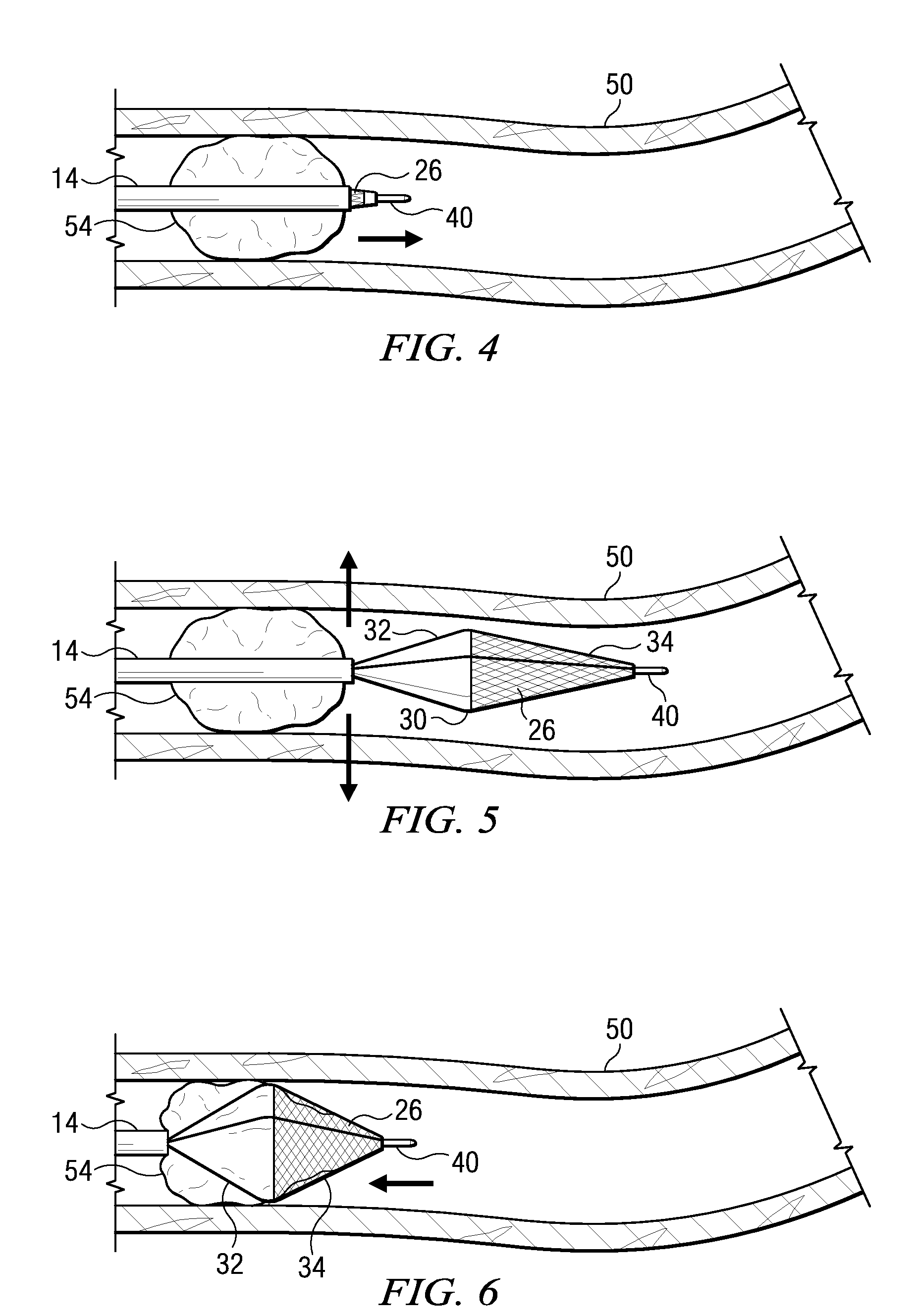 Mechanical embolectomy device and method