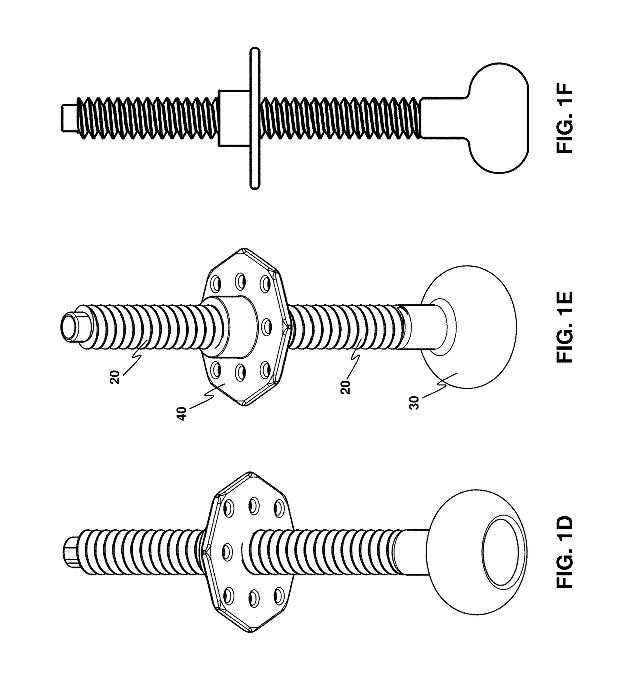 Transabdominal gastric device and method