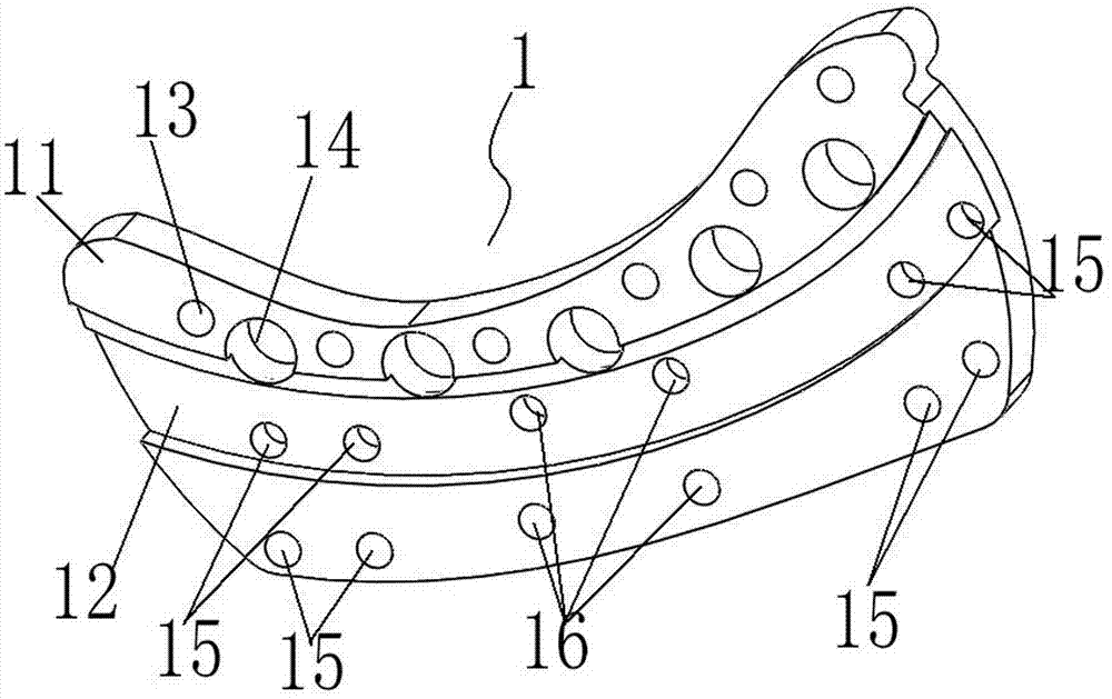 Auxiliary calcaneus reduction fixing device for calcaneus fracture occlusion or minimal invasion reduction internal fixation