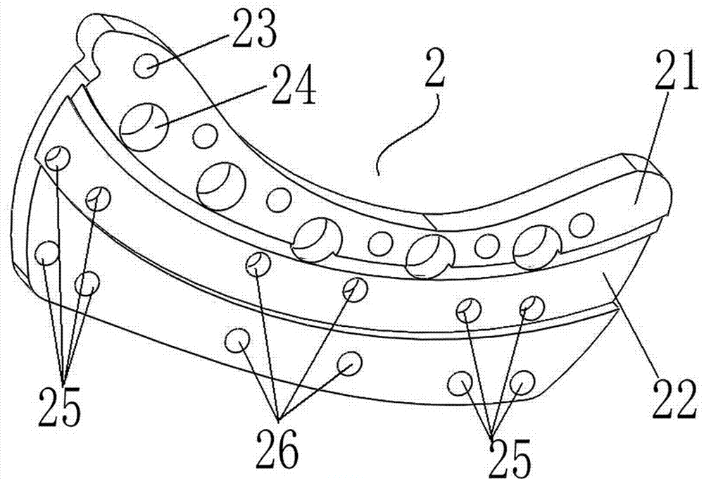 Auxiliary calcaneus reduction fixing device for calcaneus fracture occlusion or minimal invasion reduction internal fixation