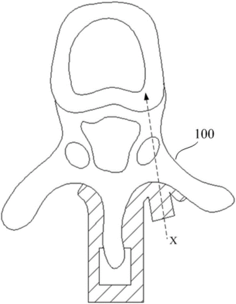 Navigation device for screw fixation