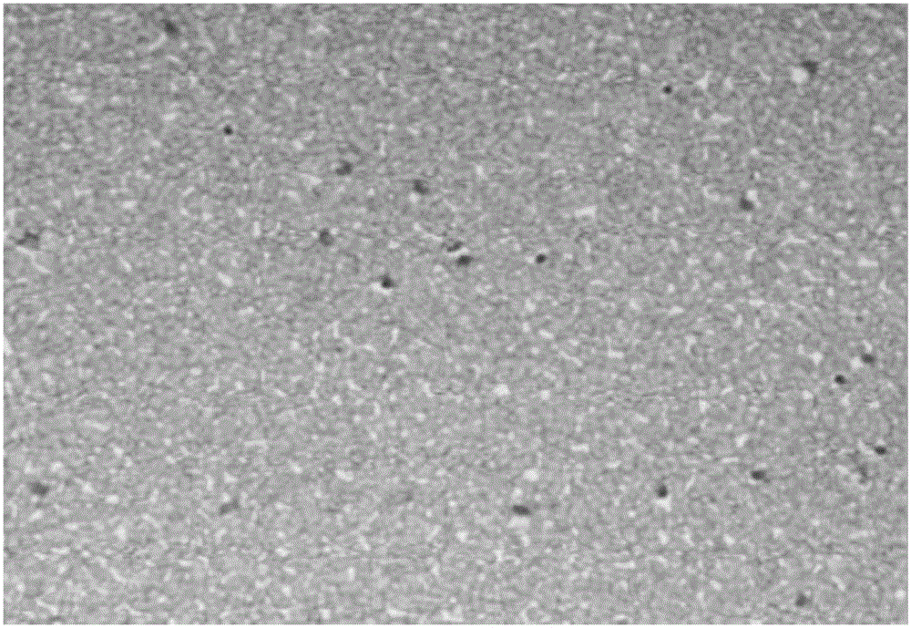 Systemic lupus erythematosus detection method