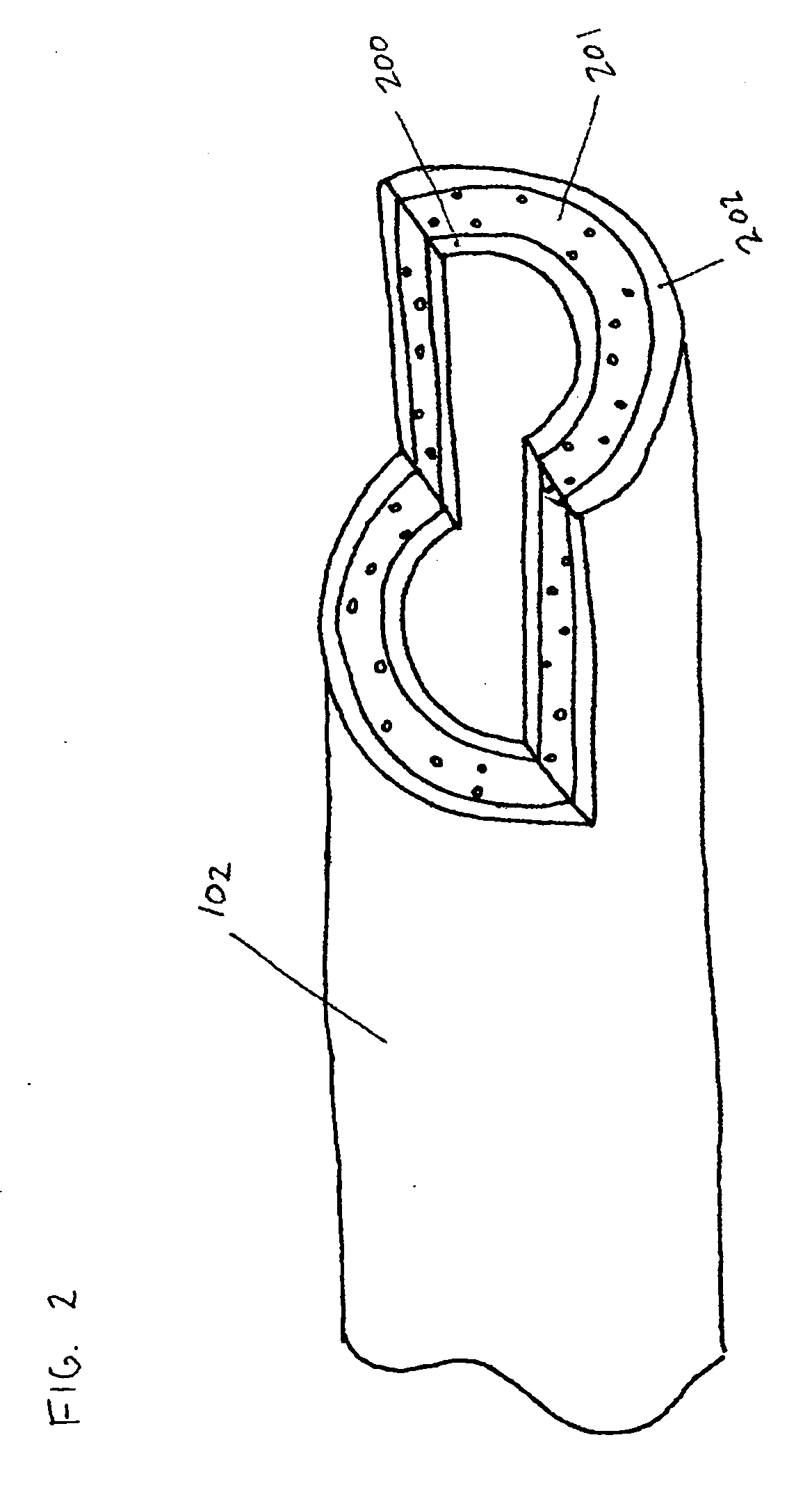 Endovascular devices and methods