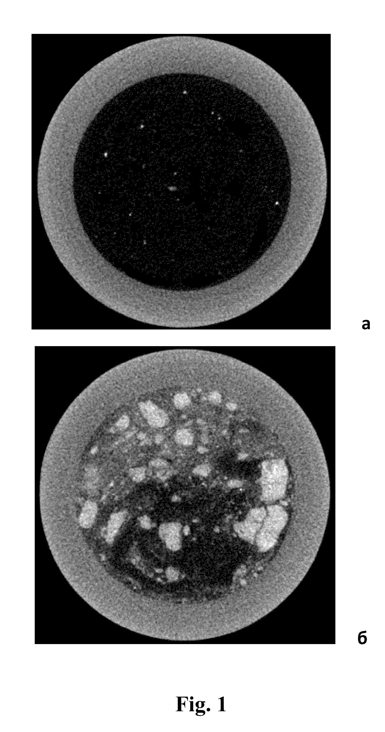 Method for determining spatial distribution and concentration of clay in a core sample