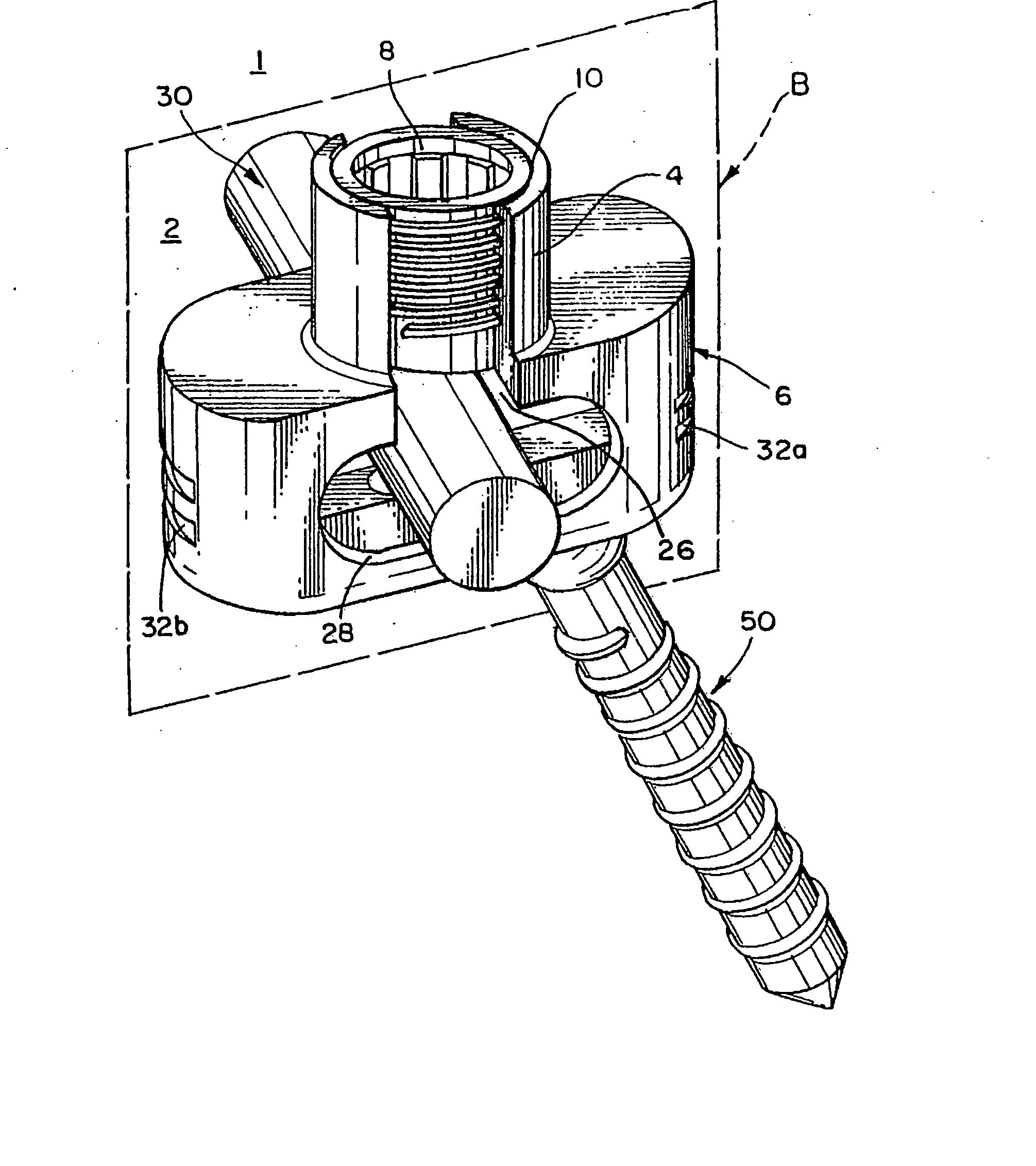 Bone screw apparatus, system and method