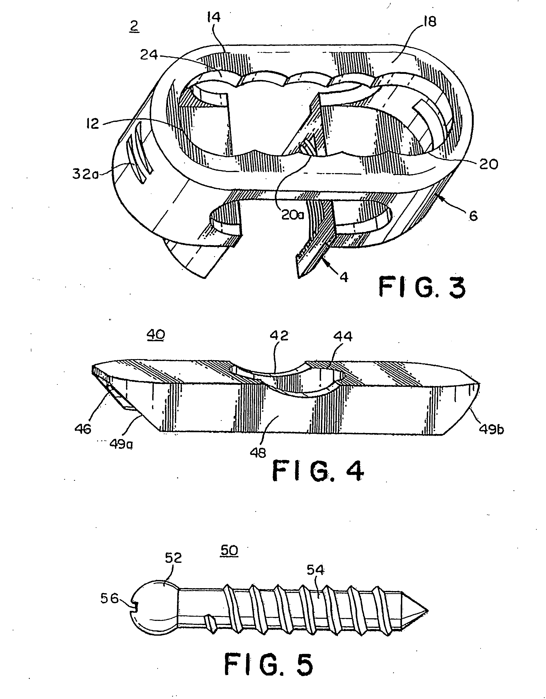 Bone screw apparatus, system and method