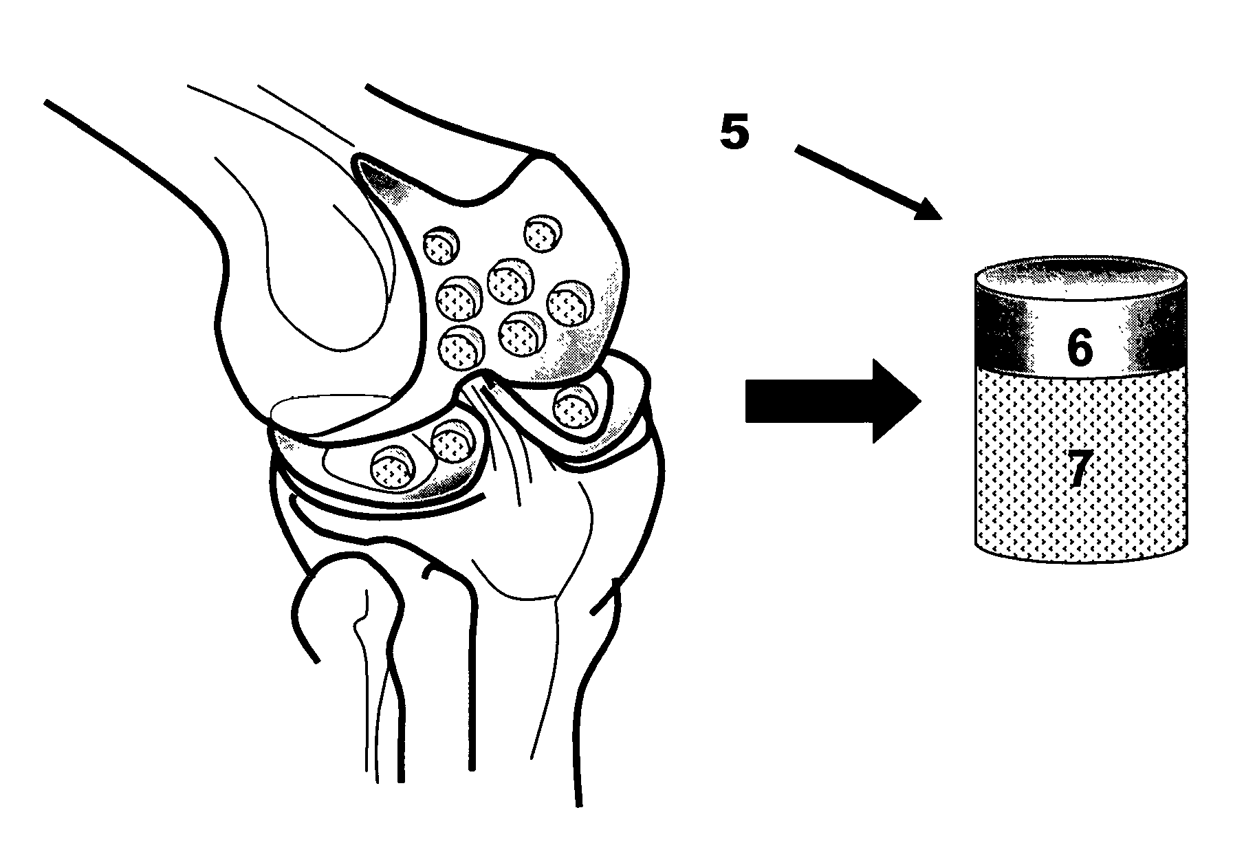 Devitalization and recellularization of cartilage