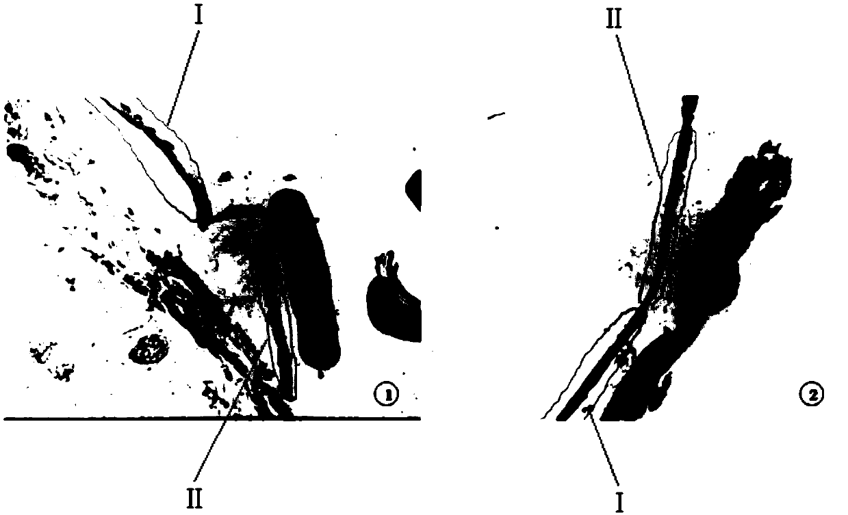 A screening method for marker proteins of lgien and hgien before esophageal squamous cell carcinoma