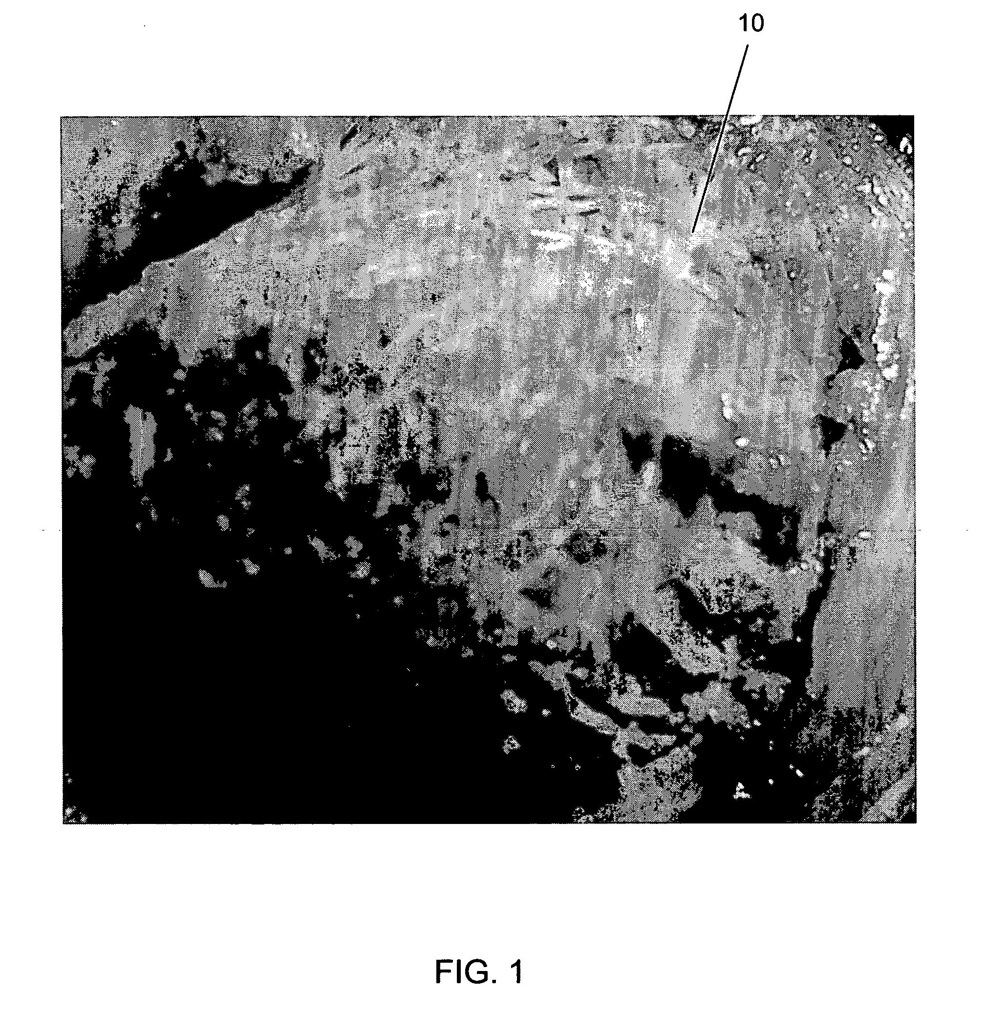 Kit for treating bony defects