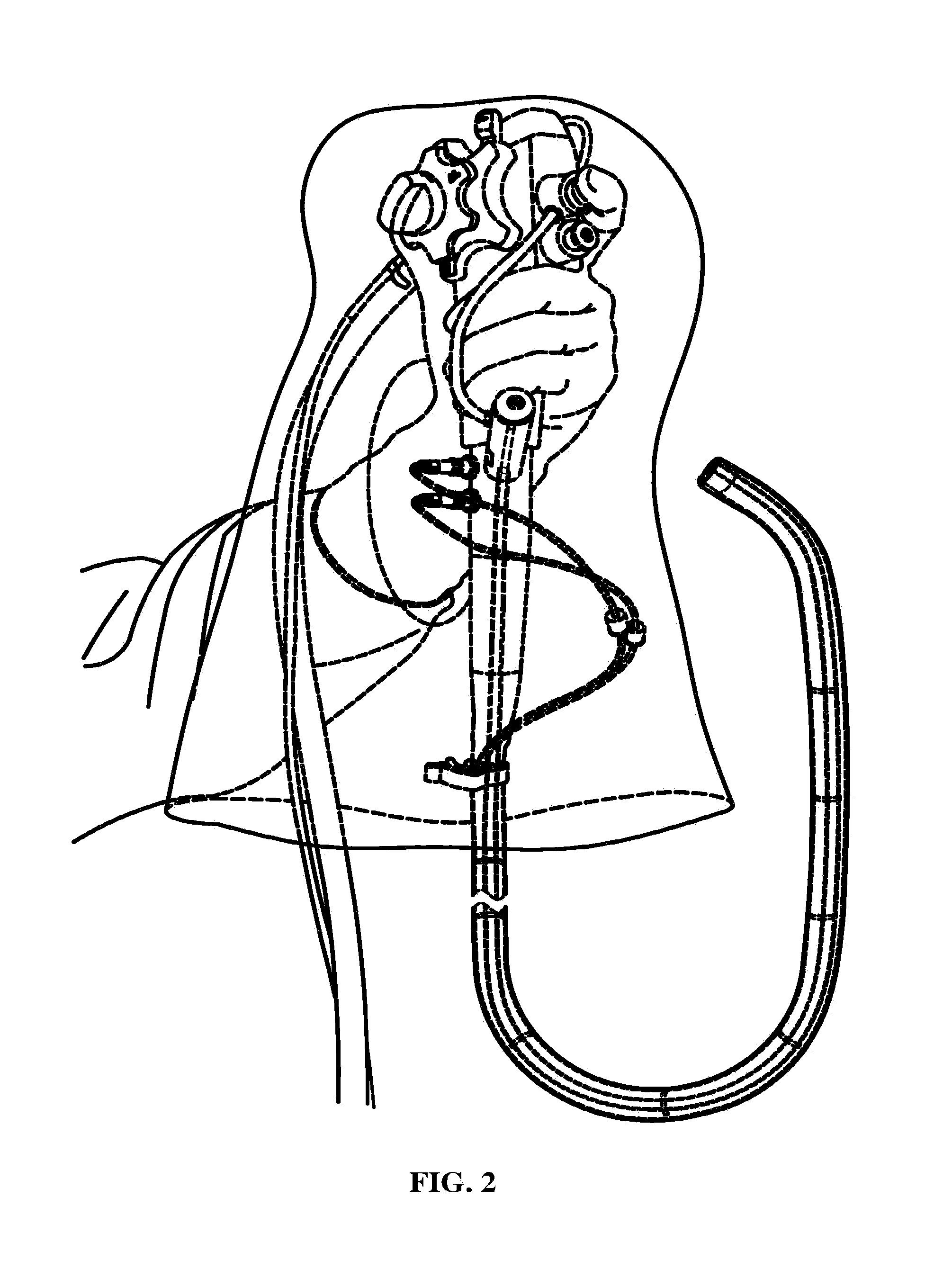 Endoscope disposable sheath