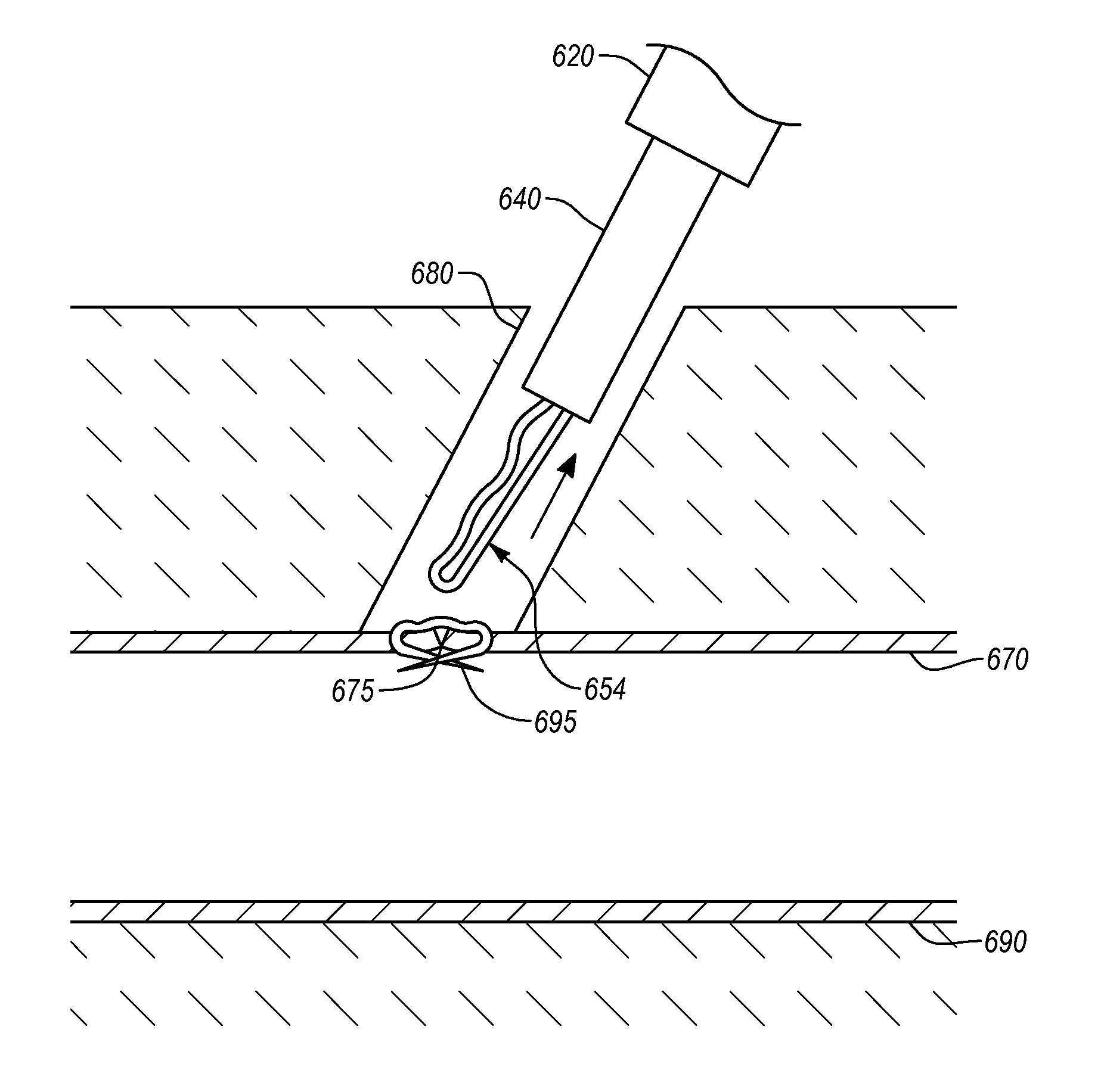 Closure devices, systems, and methods