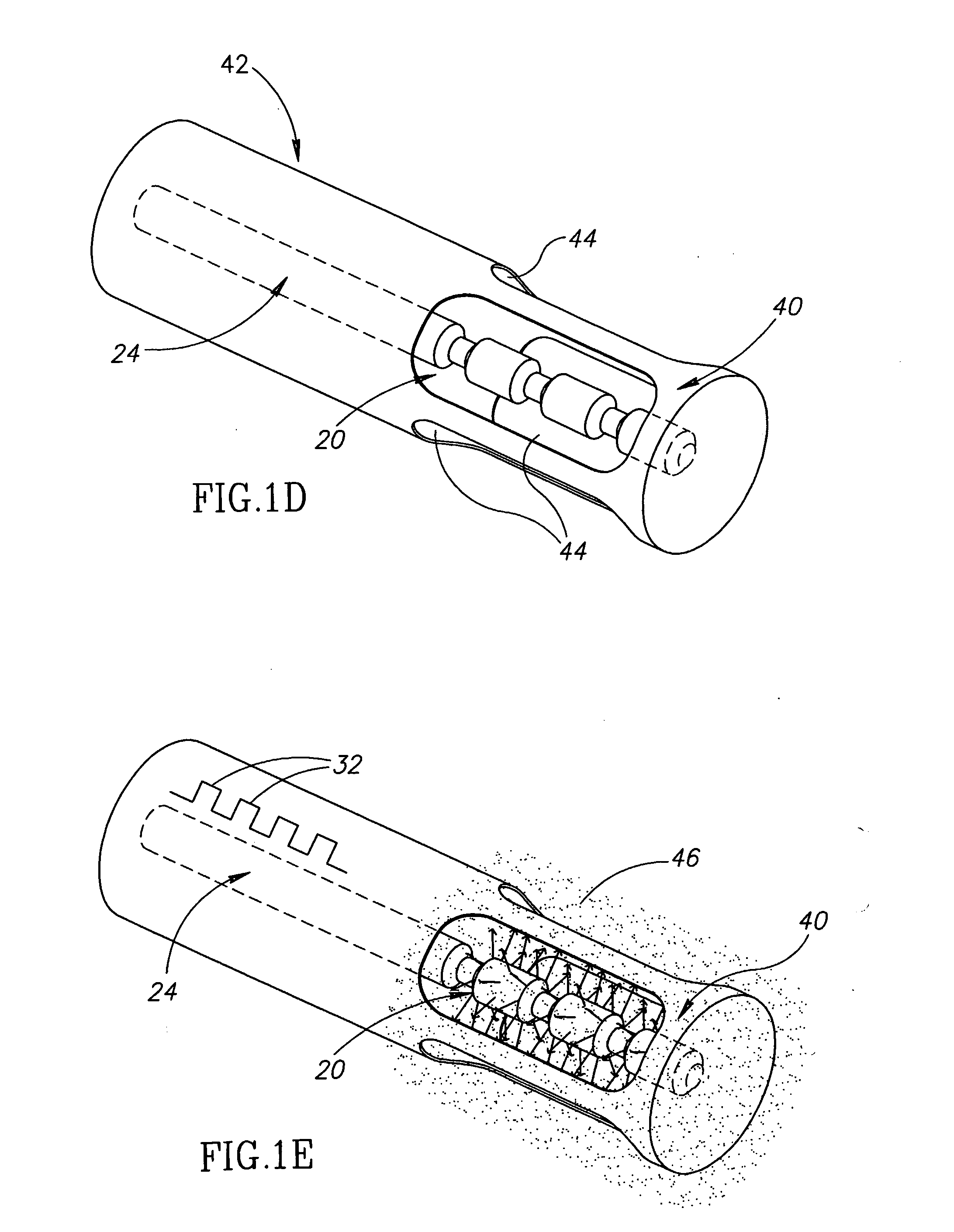 Ultrasonic Drug-Delivery System