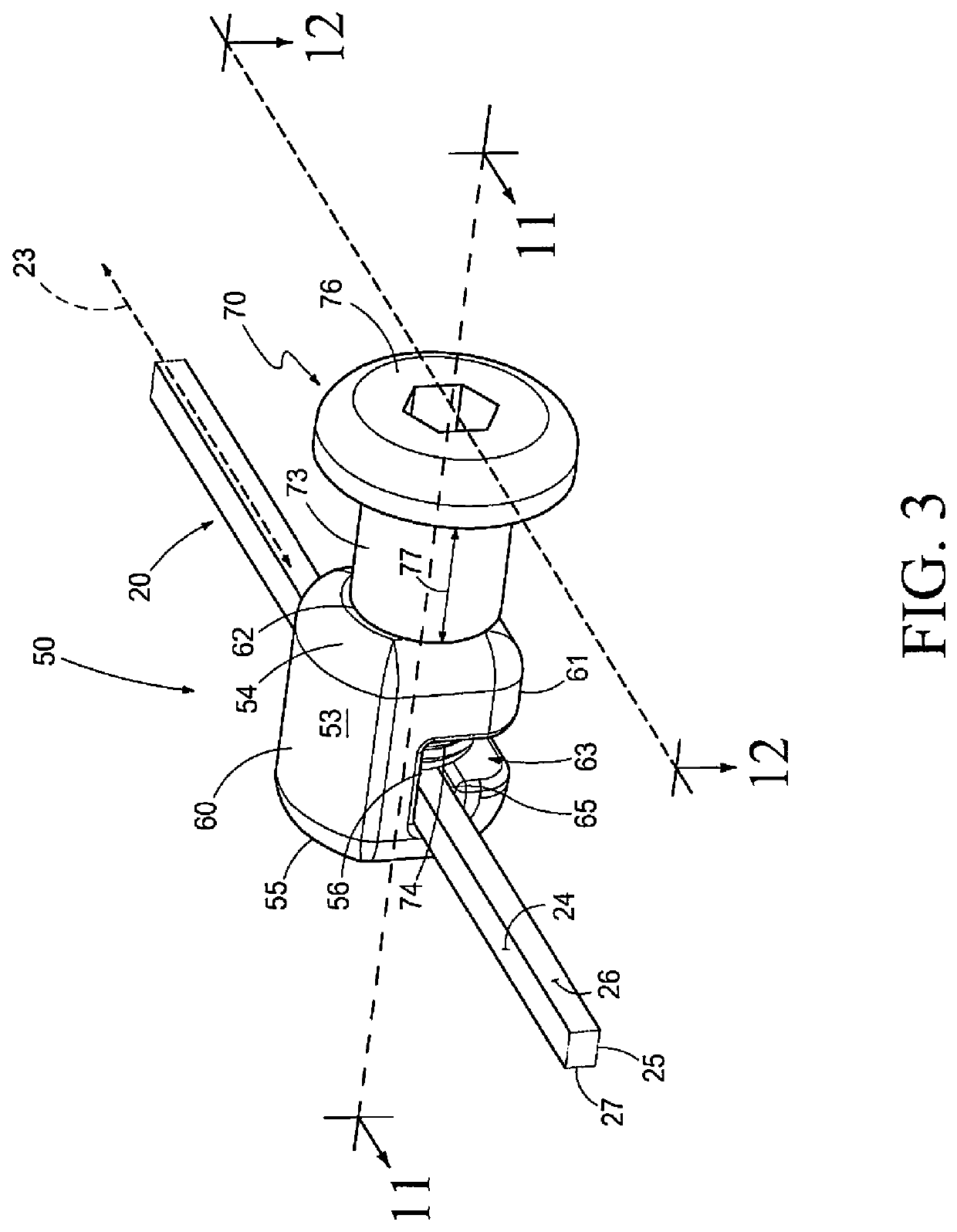 Method and Apparatus for Treating Malocclusions and Teeth Alignment