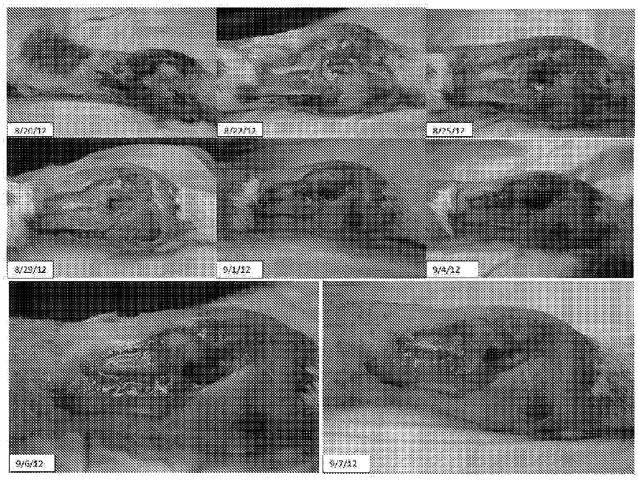 C. novyi for the treatment of solid tumors in humans