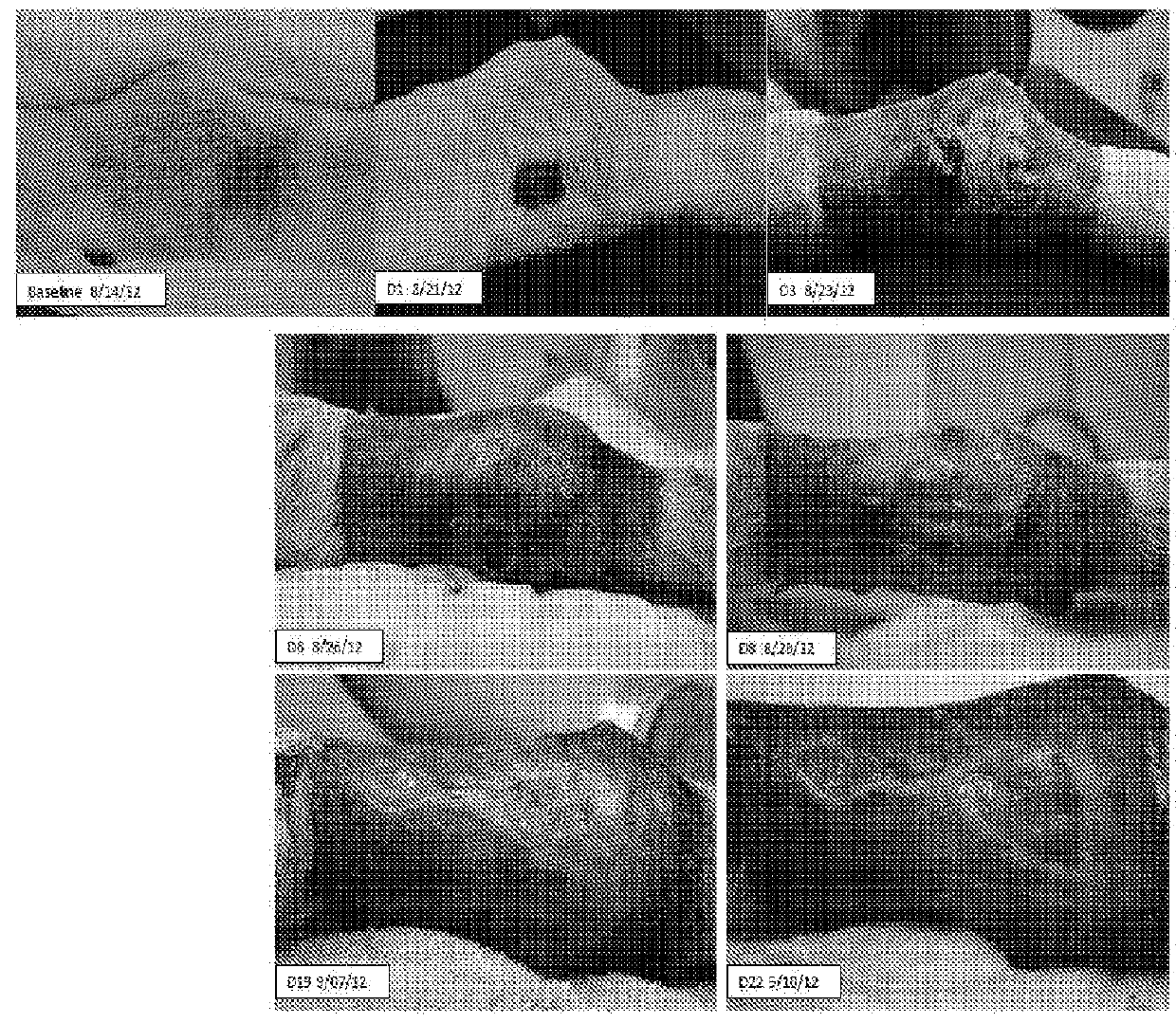 C. novyi for the treatment of solid tumors in humans