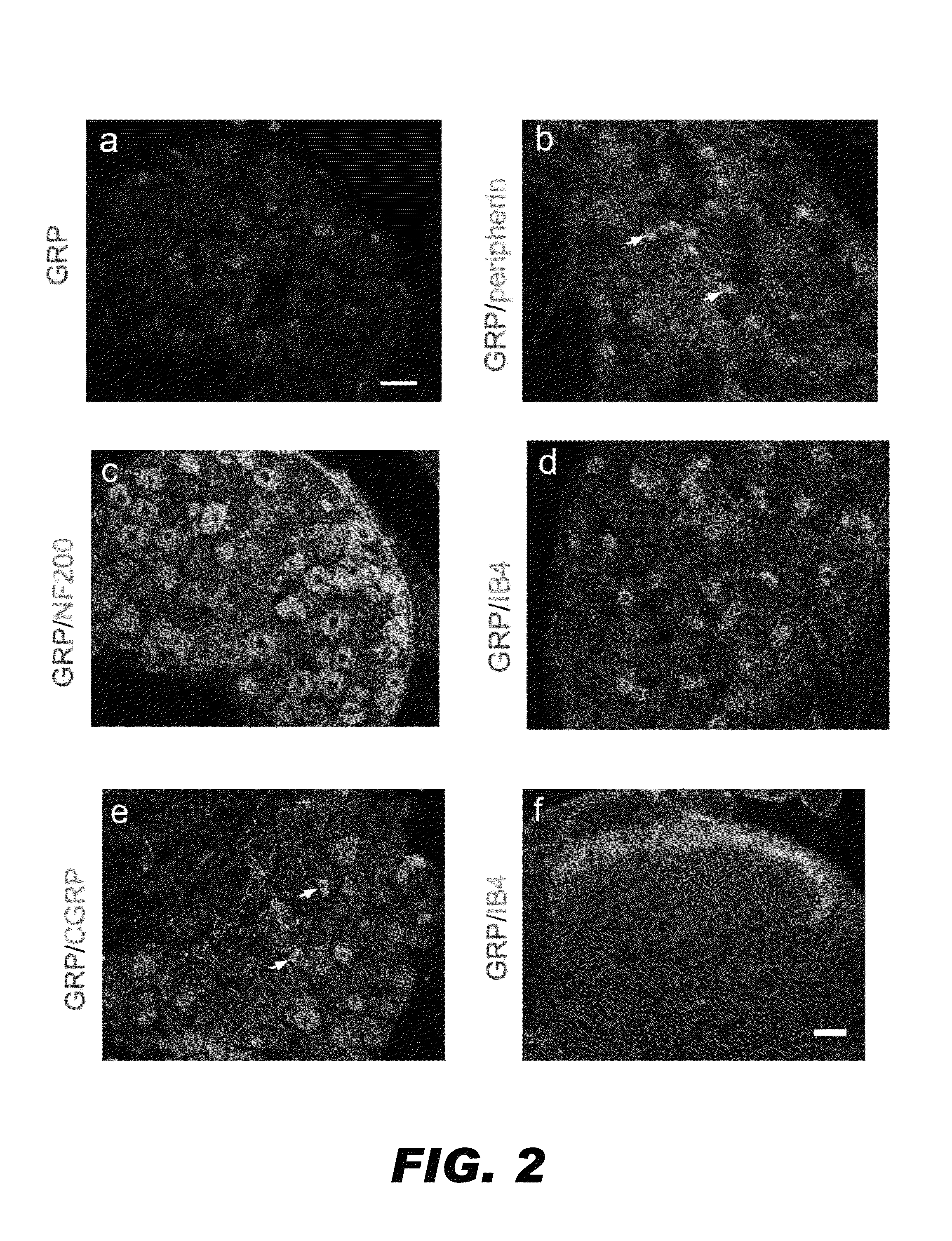 Compositions and methods for treating pruritus