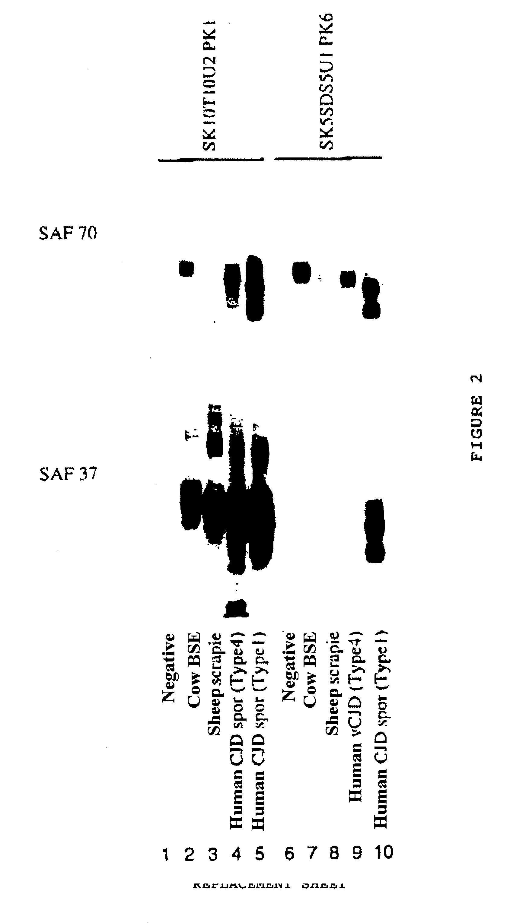 Method for diagnosing a transmissible spongiform subacute encephalyopathy caused by an unconventional transmissible agent strain in a biological sample