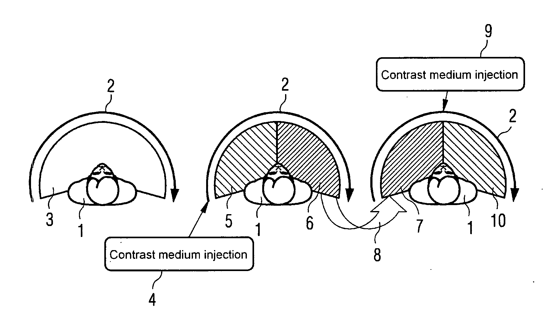 Method and device for separate three-dimensional presentation of arteries and veins in a part of body