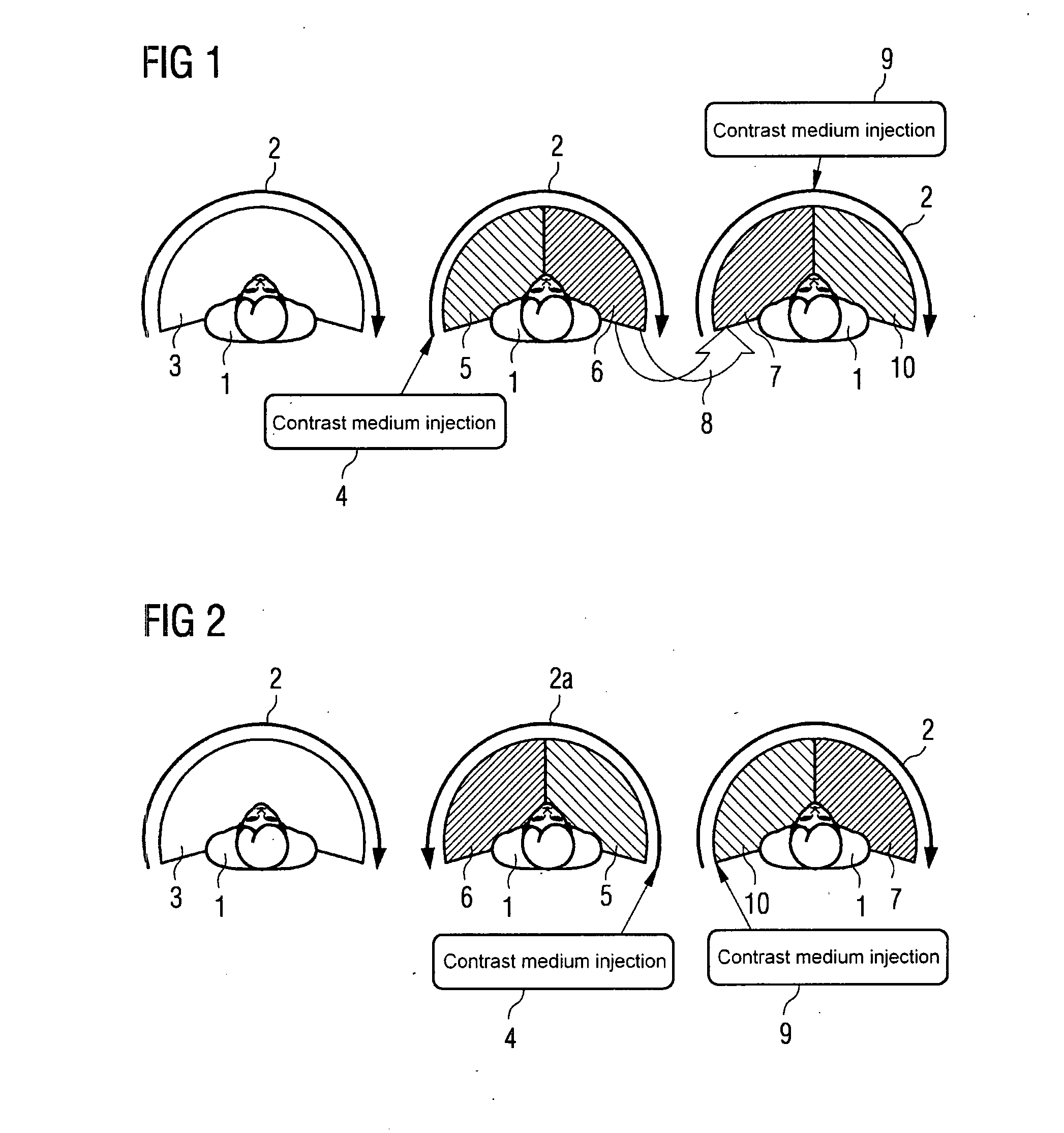 Method and device for separate three-dimensional presentation of arteries and veins in a part of body