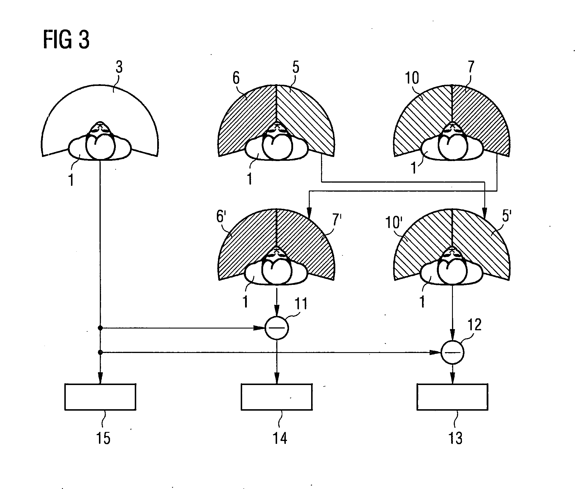 Method and device for separate three-dimensional presentation of arteries and veins in a part of body