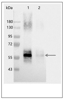 Plant light system I polyclonal antibody and preparation method thereof