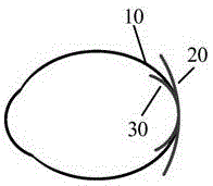 Internal oculoscope