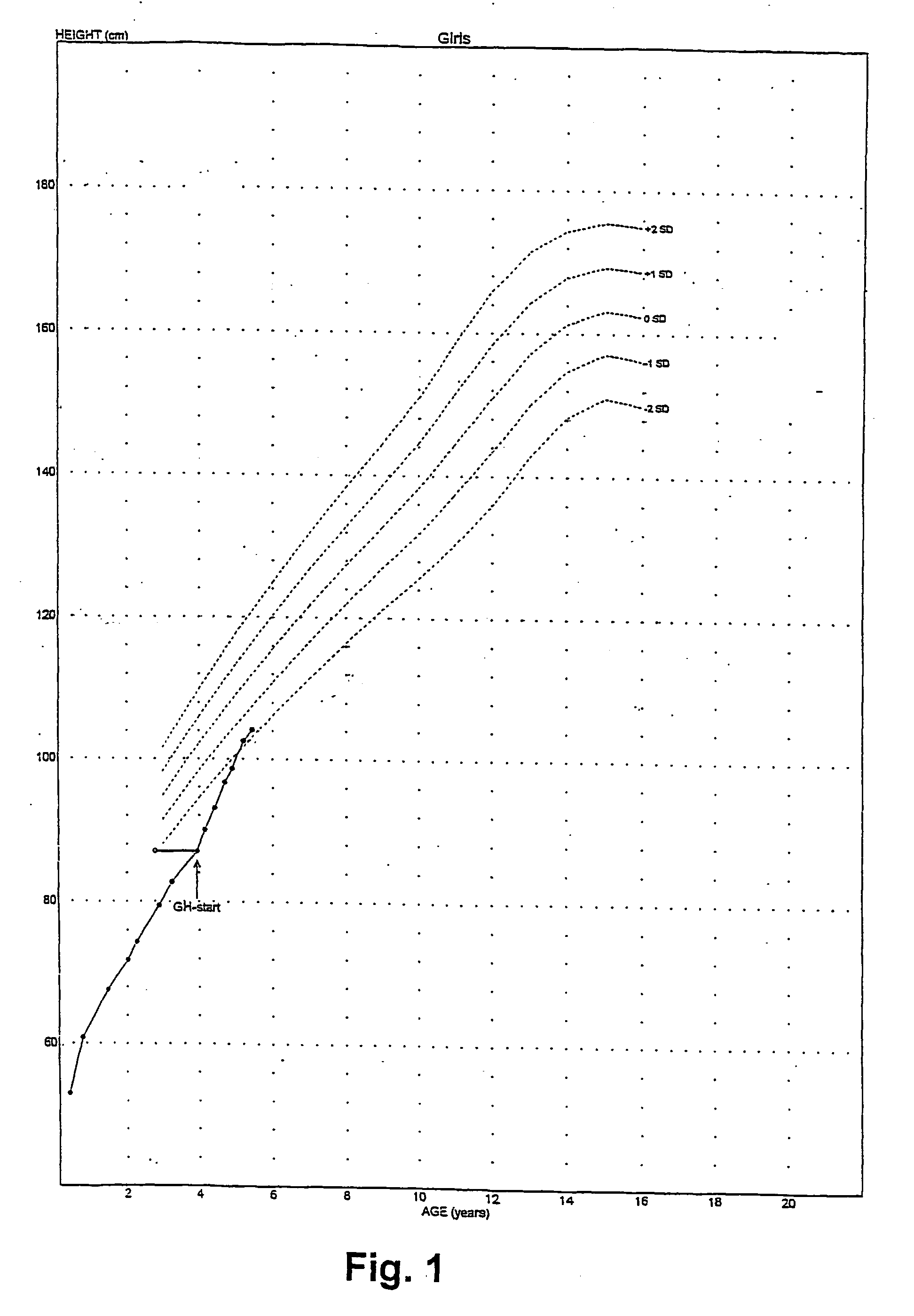 Human growth hormone for treating children with abnormal short stature and kits and methods for diagnosing gs protein dysfunctions