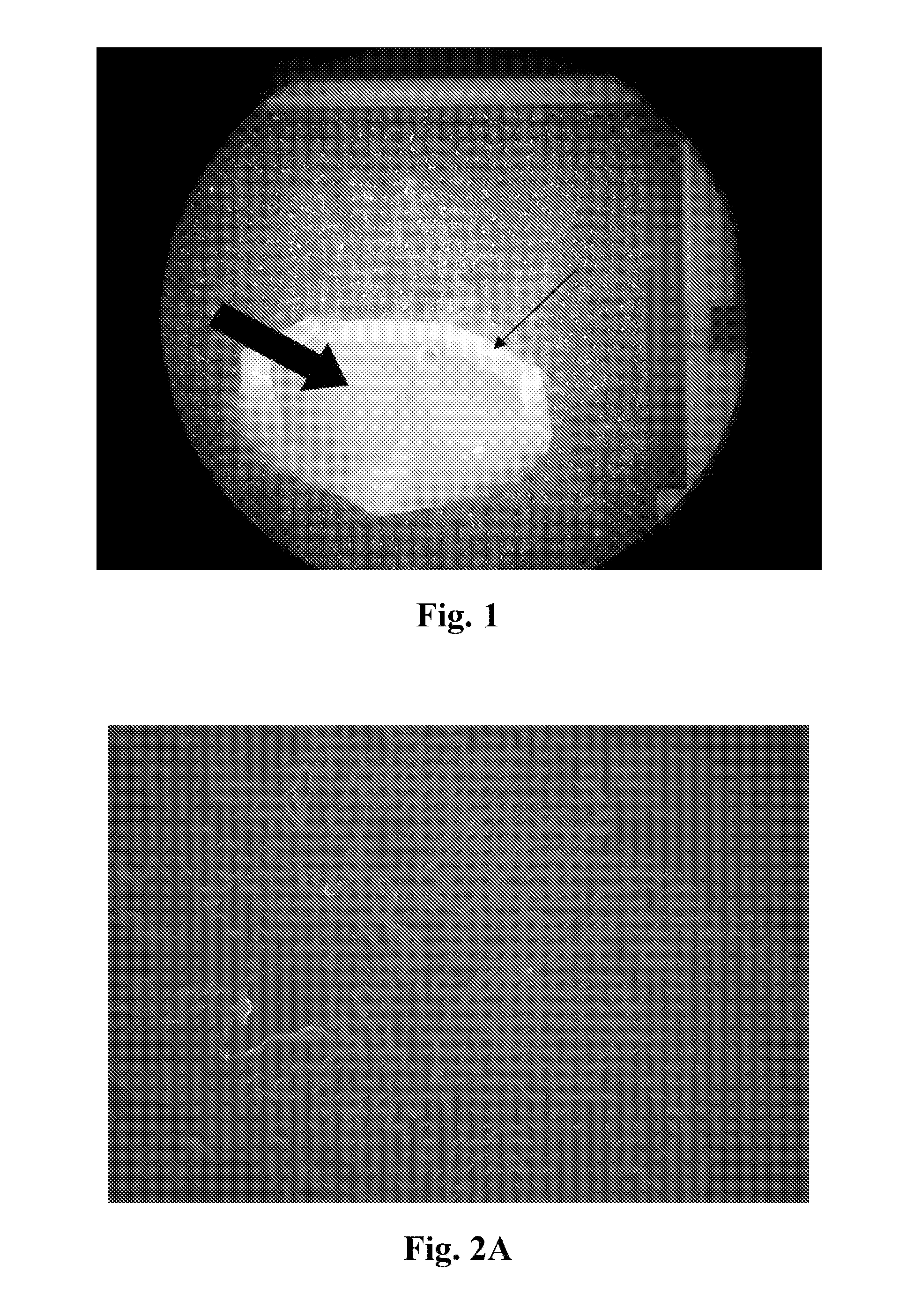 Neural scaffolds