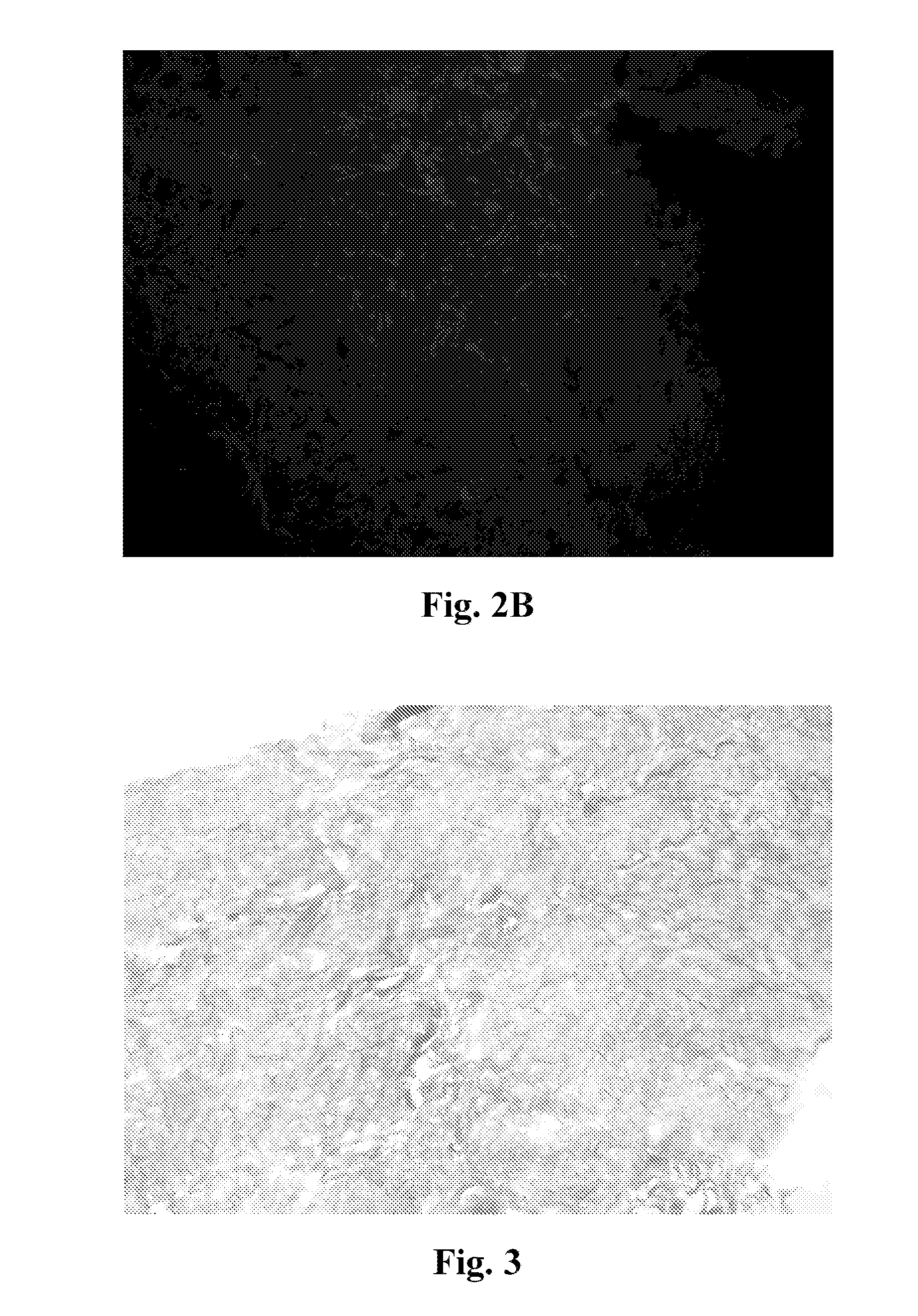 Neural scaffolds