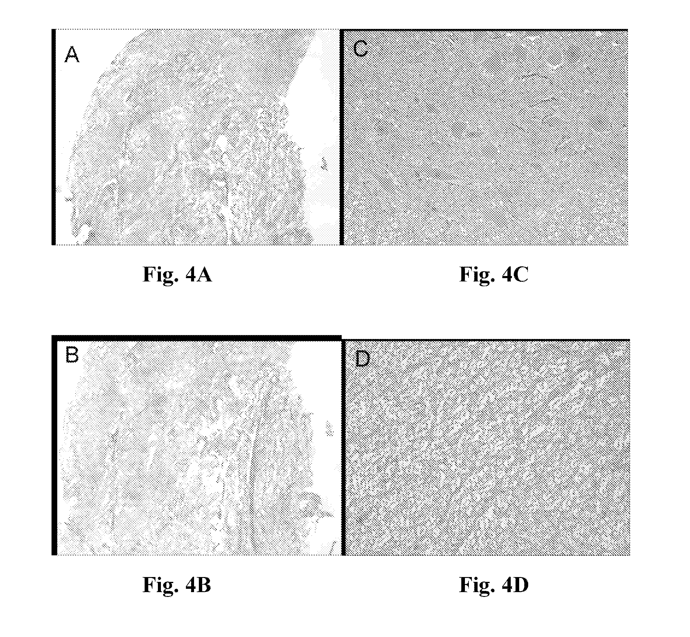 Neural scaffolds