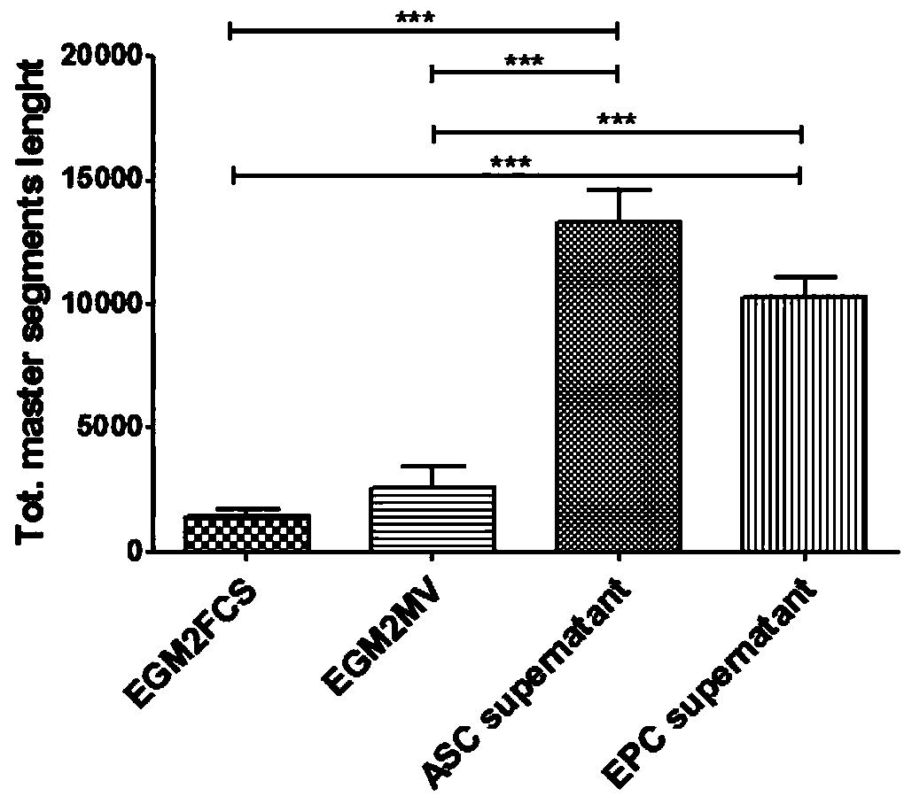 ADSCs and EPCs stem cell system capable of promoting recovery of microcirculation blood supply of graft