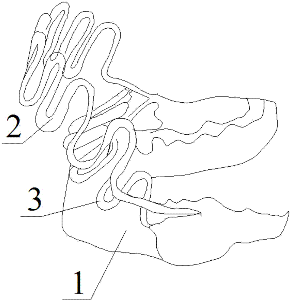 An upper and lower jaw interactive corrector