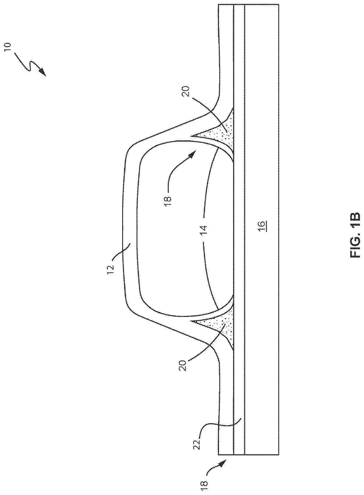 Method for Determining Noodle and Interface Residual Stresses and Properties Under Hygrothermal-Mechanical Loadings