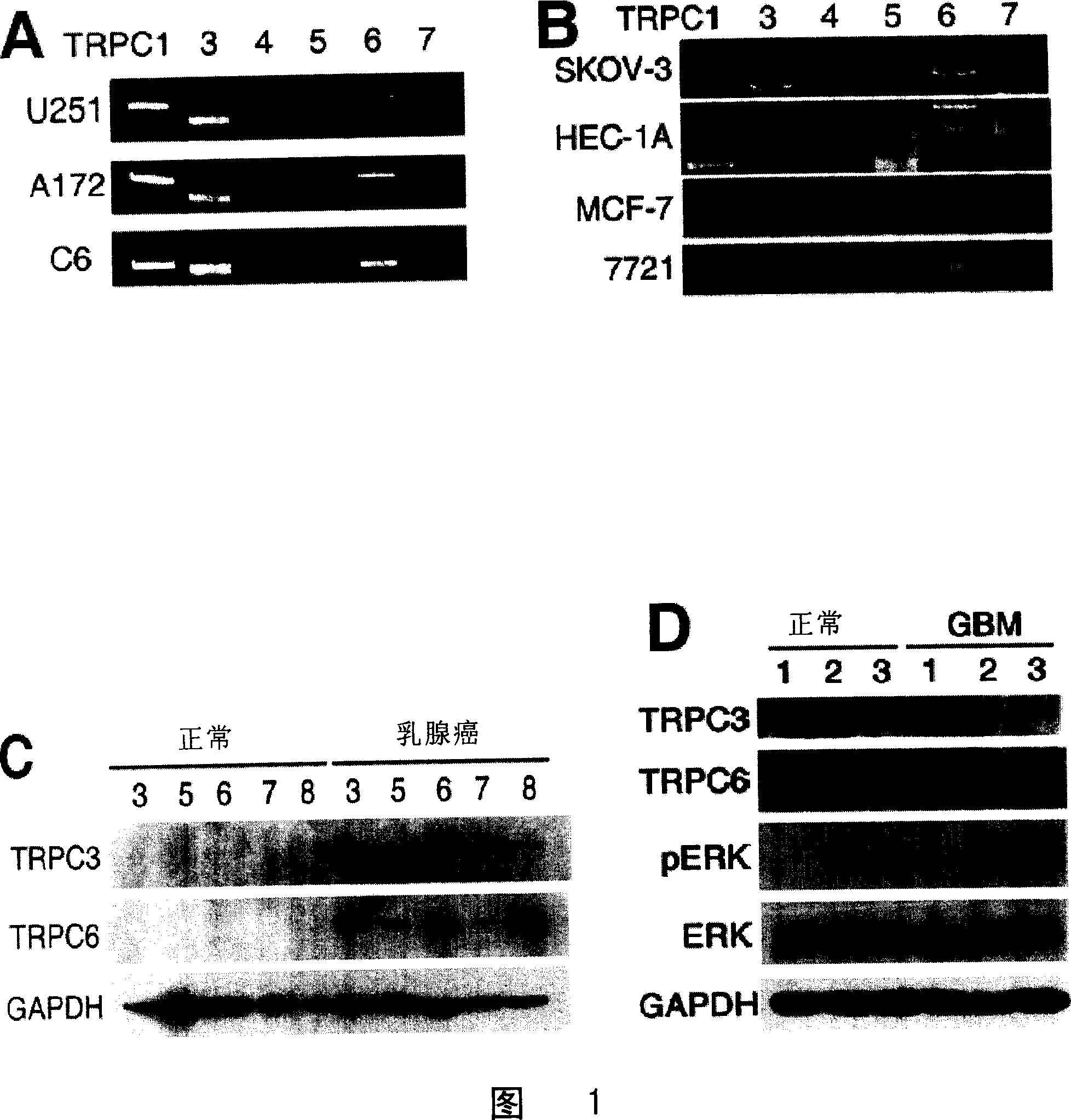 Application of TRPC in screening antitumour medicine and medical use of its inhibitor